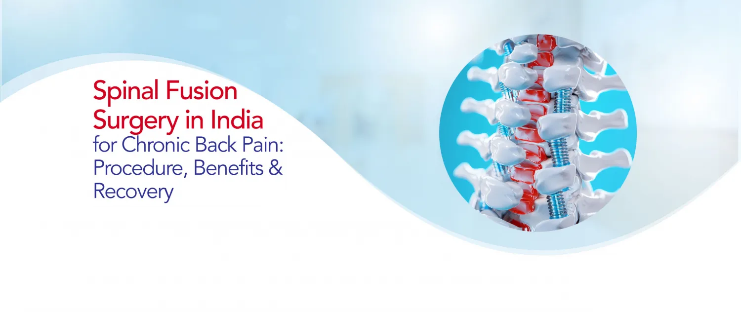 Spinal Fusion Surgery in India for Chronic Back Pain: Procedure, Benefits & Recovery